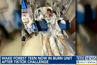 ΗΠΑ: Έφηβος τυλίχθηκε στις φλόγες εξαιτίας μιας πρόκλησης στο TikTok